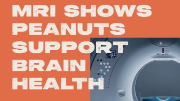 Longer-Term Skin-Roasted Peanut Consumption Improves Brain Vascular Function and Memory