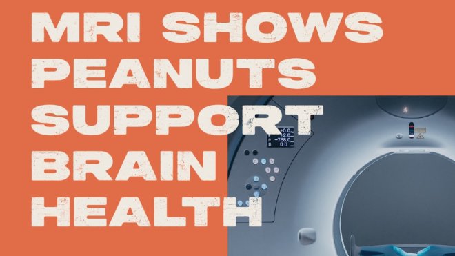Longer-Term Skin-Roasted Peanut Consumption Improves Brain Vascular Function and Memory